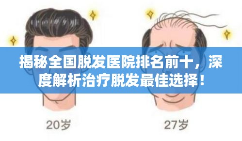 揭秘全国脱发医院排名前十，深度解析治疗脱发最佳选择！